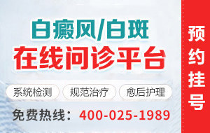 兰州银屑病医院