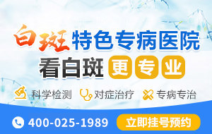 兰州银屑病医院